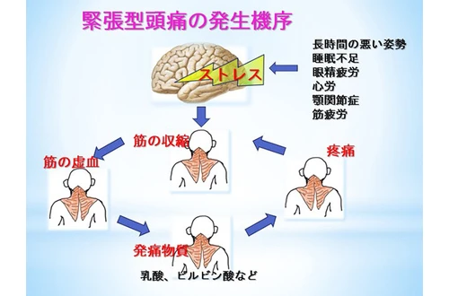 様々な薬剤の中から最適なものを選びます