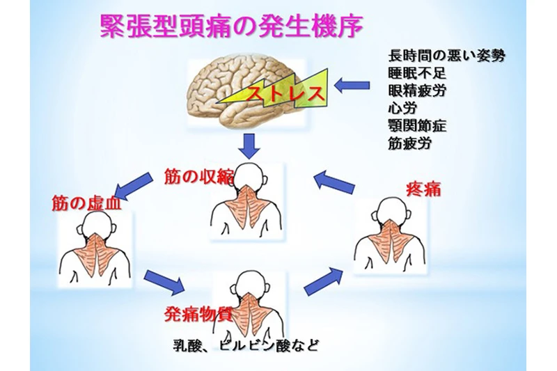 様々な薬剤の中から最適なものを選びます